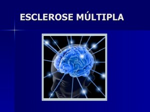 esclerose-mltipla-1-728