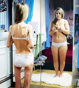 o-que-e-a-anorexia-foto