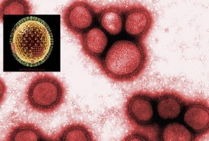 Vírus Gripe Comum